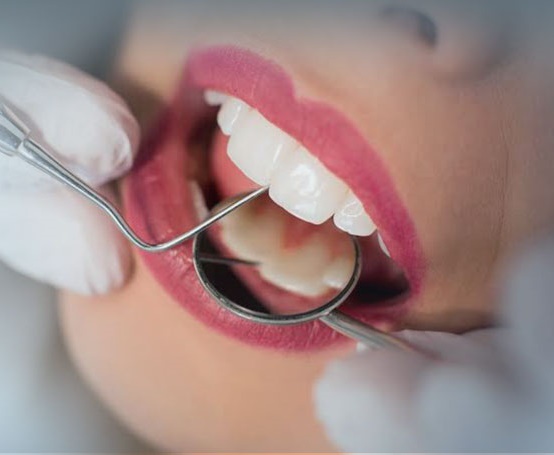 Konya Endodonti Kanal Tedavisi ve Güncel Fiyatları - Gürses Dental