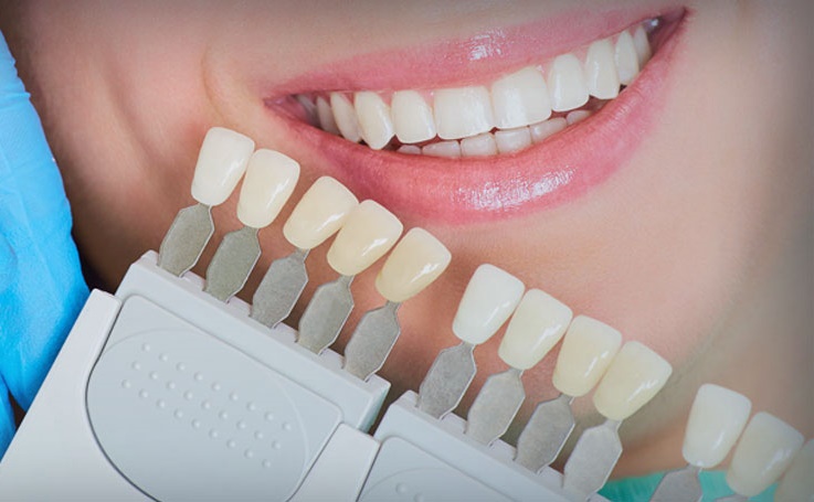 Kayseri Zirkonyum Diş Kaplama ve Tedavisi - Gürses Dental